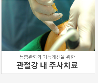 관절강 내 주사치료